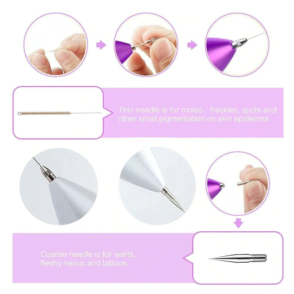 SkinPerfect Plasma Pen Mole & Spot Eraser