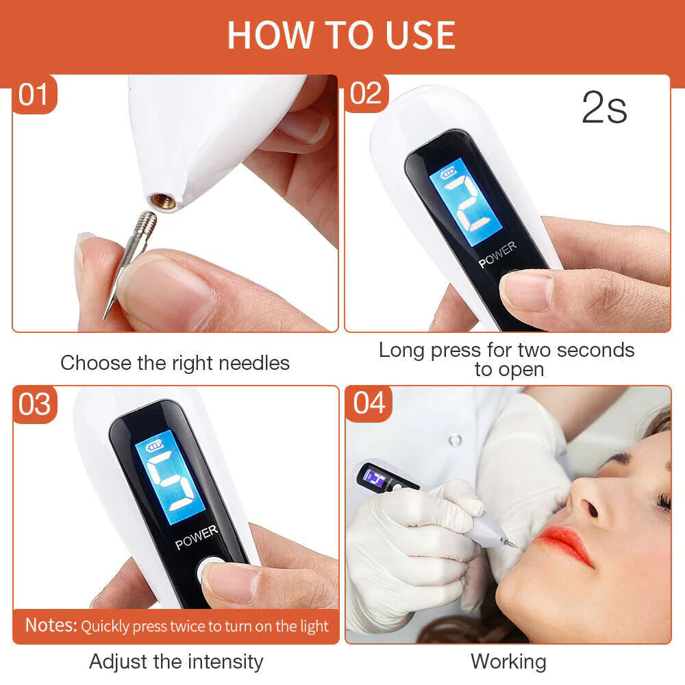 SkinPerfect Plasma Pen Mole & Spot Eraser
